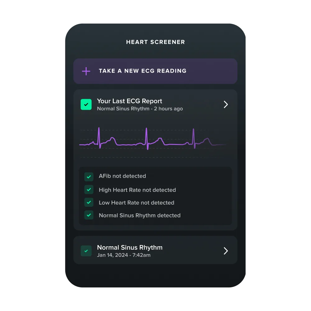 WHOOP 5.0 Review: New Features, Pricing, & Health Insights – Is It Worth the Upgrade? 8 Demonstration of WHOOP 5.0 ECG tracking in review, available in Life plan